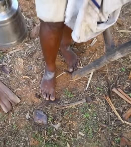 Mark on the foot